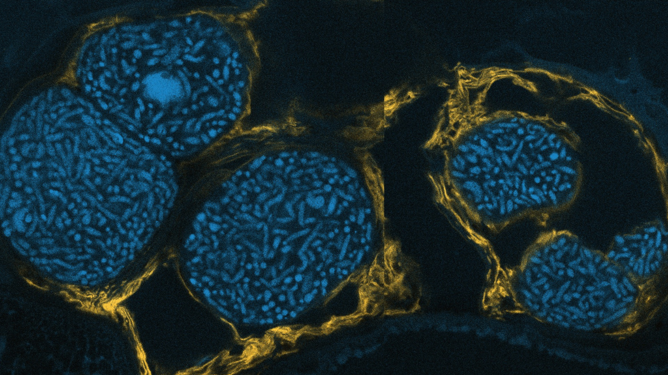 Microscopy image shows Candidatus Stammera bacteria wrapped in a protective Yellow protein coat – by Christiane Emmerich